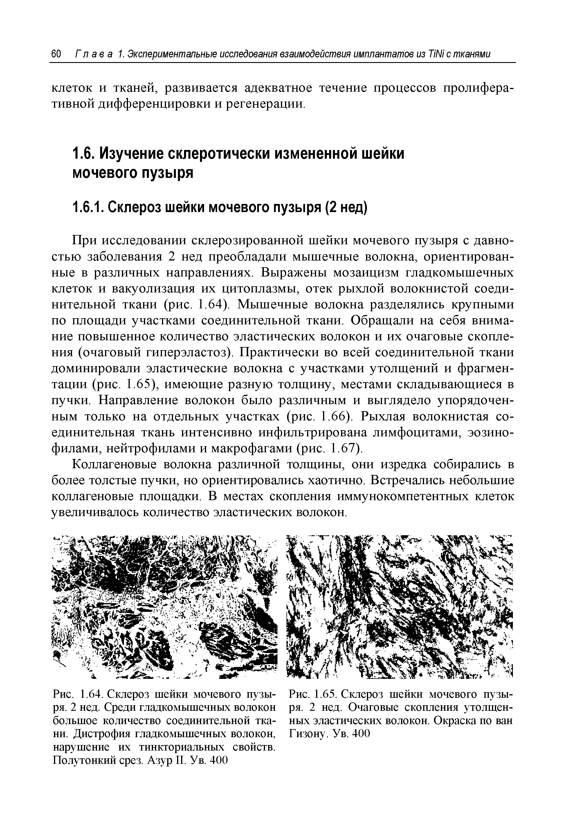 Рис. 1.64. Склероз шейки мочевого пузыря. 2 нед. Среди гладкомышечных волокон большое количество соединительной ткани. Дистрофия гладкомышечных волокон, нарушение их тинкториальных свойств. Полутонкий срез. Азур II. Ув. 400...