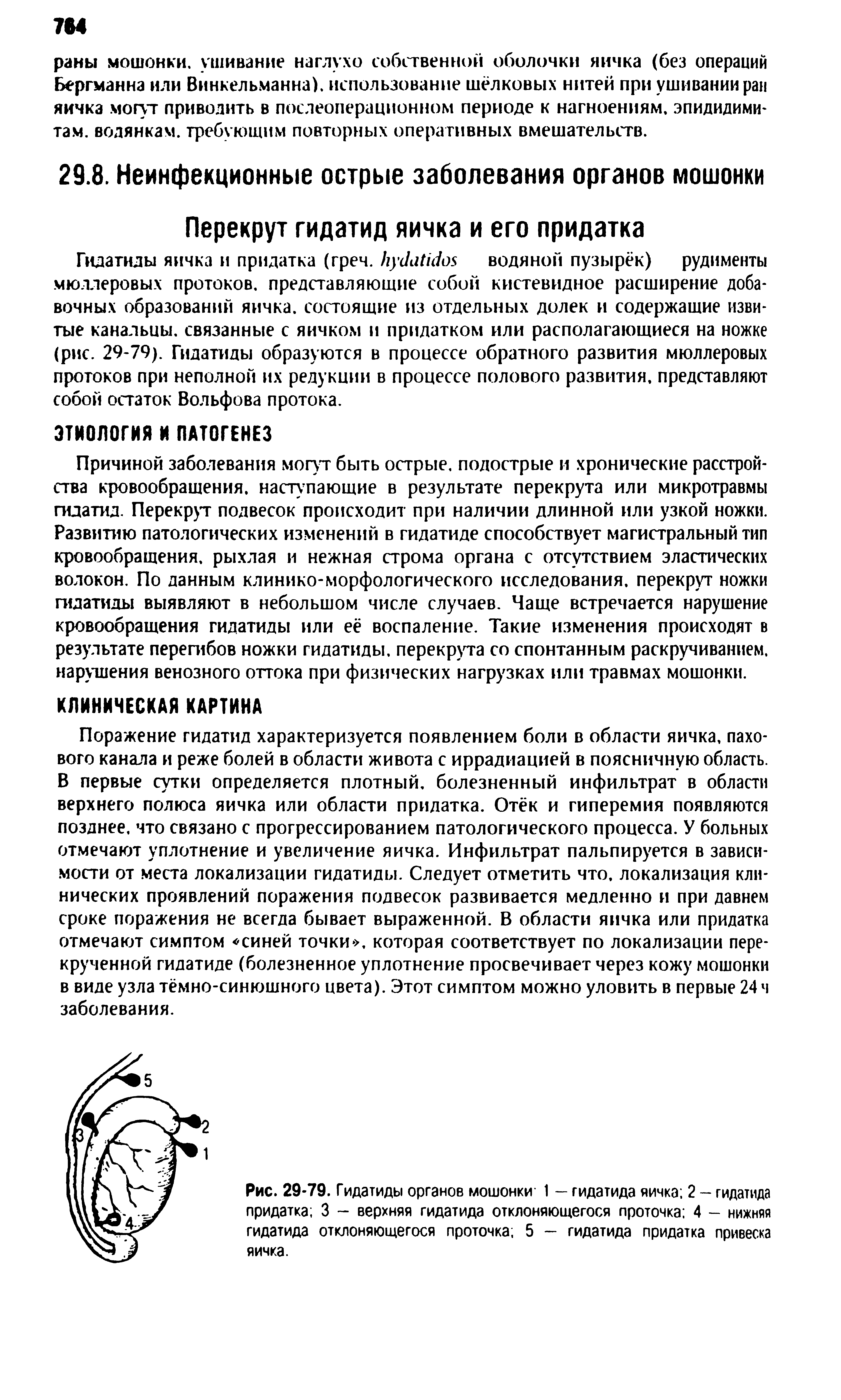 Рис. 29-79. Гидатиды органов мошонки 1 - гидатида яичка 2 - гидатида придатка 3 - верхняя гидатида отклоняющегося проточка 4 - нижняя гидатида отклоняющегося проточка 5 — гидатида придатка привеска яичка.