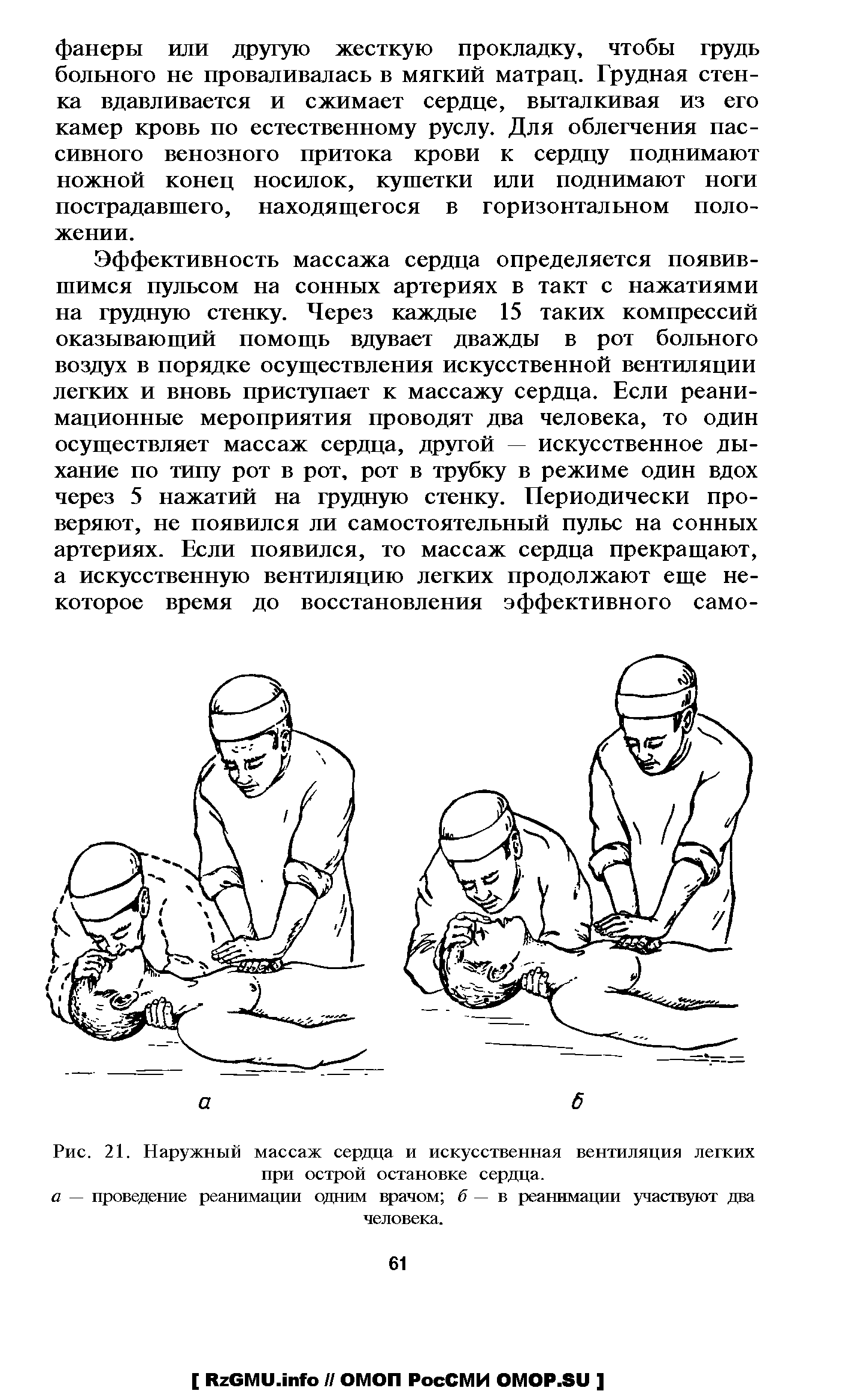 Рис. 21. Наружный массаж сердца и искусственная вентиляция легких при острой остановке сердца.