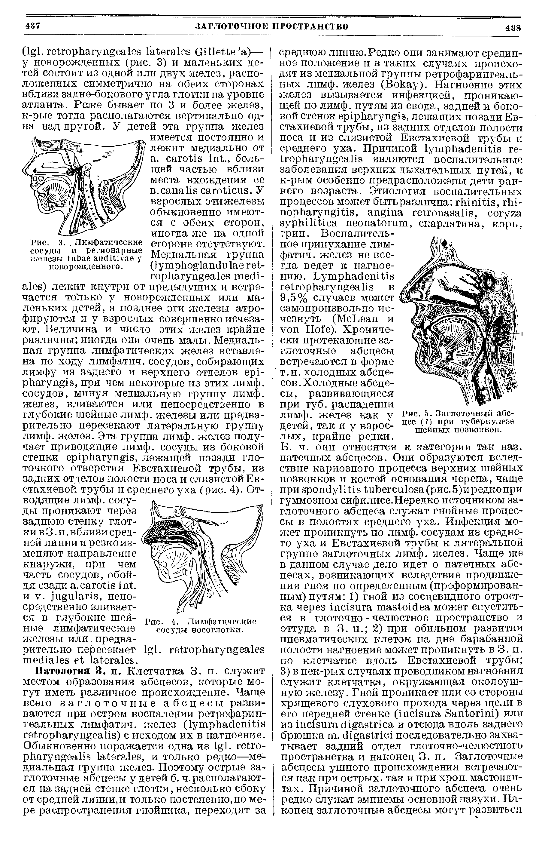 Рис. 3.. Лимфатические сосуды и регионарные железы у новорожденного.