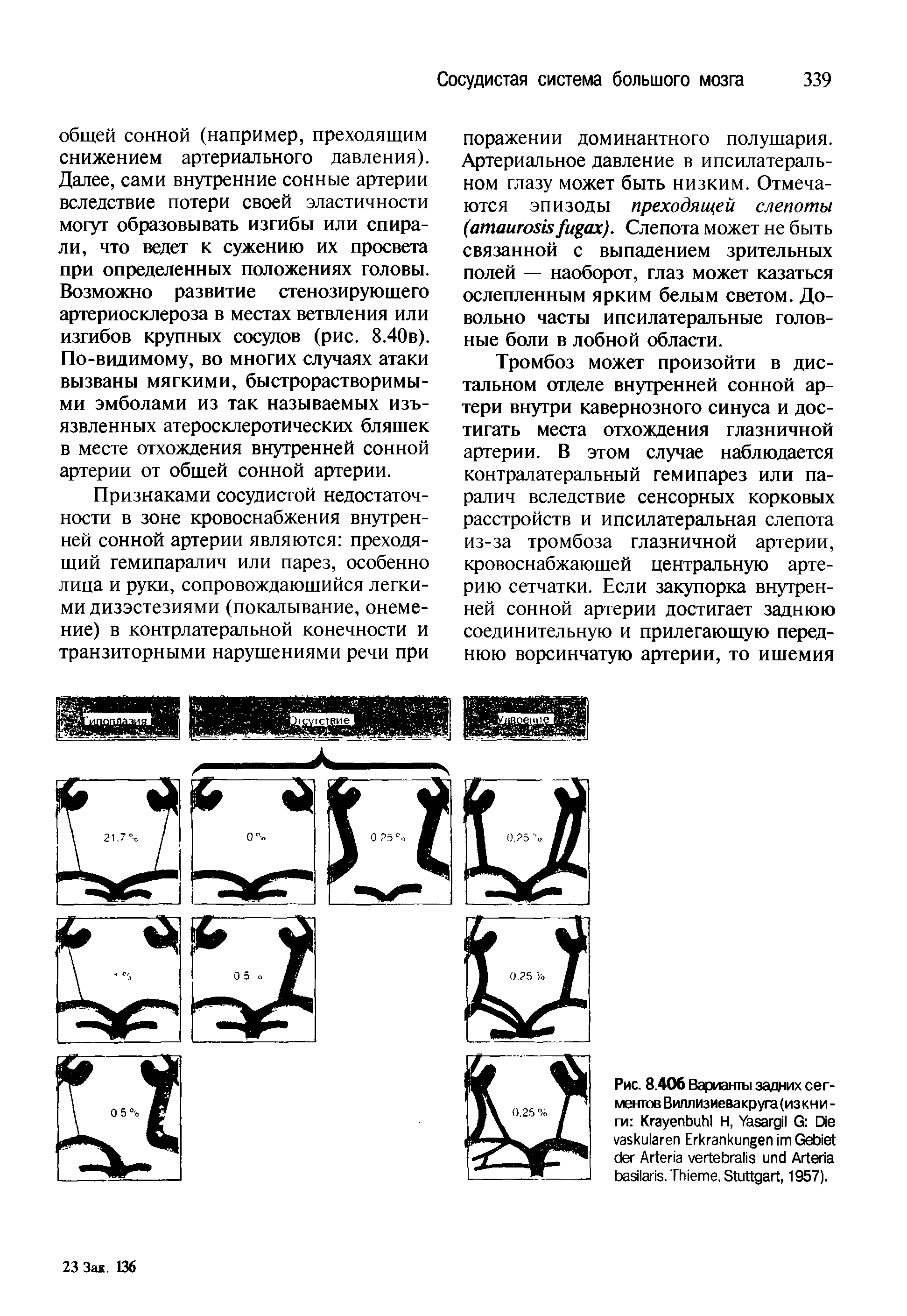 Рис. 8.406 Варианты задних сегментов Виллизиевакруга(изкни -ги K Н, Y G D E G A A . T , S , 1957).