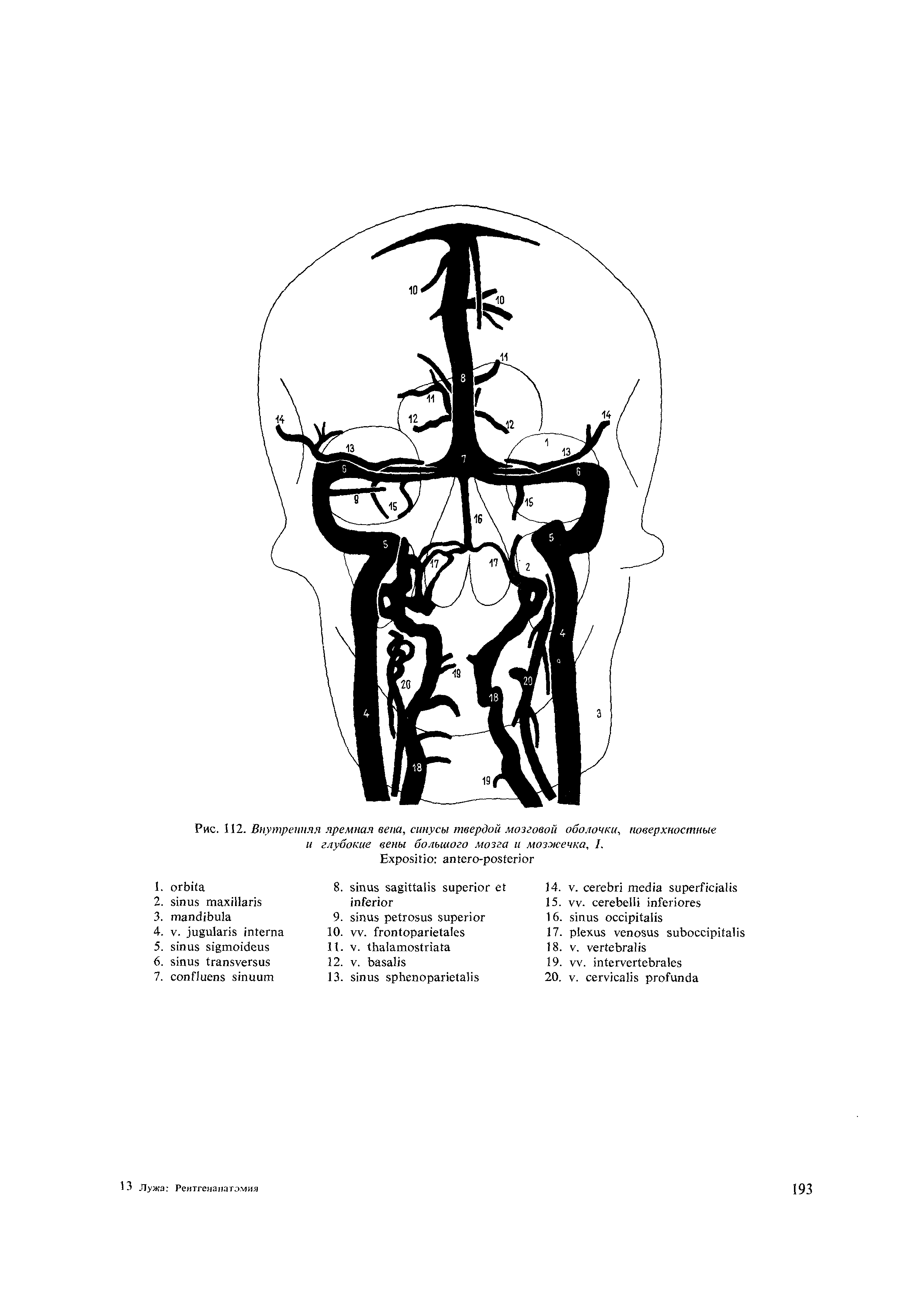 Рис. 112. Внутренняя яремная вена, синусы твердой мозговой оболочки, поверхностные и глубокие вены большого мозга и мозжечка, /.