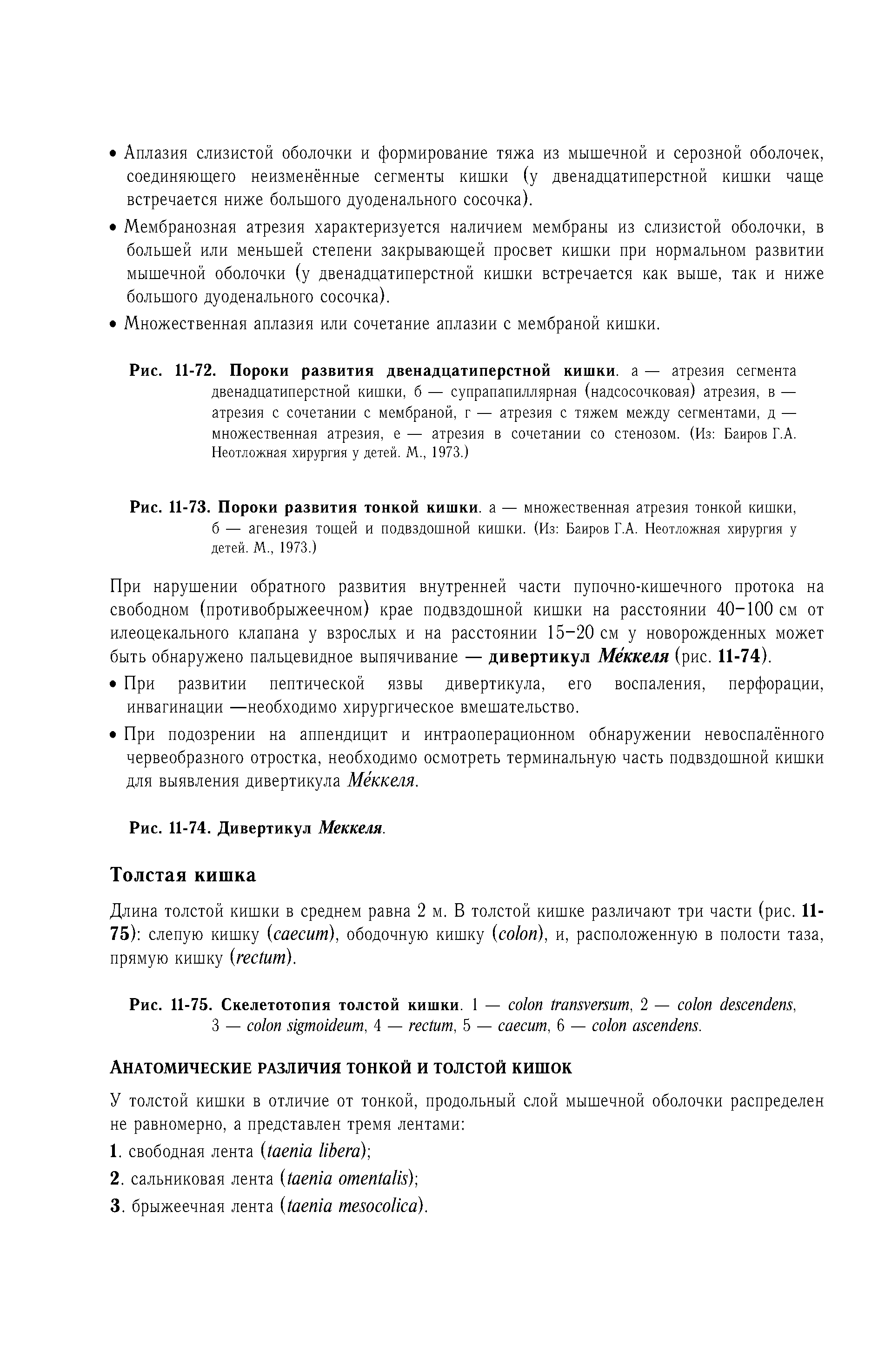 Рис. 11-73. Пороки развития тонкой кишки, а — множественная атрезия тонкой кишки, б — агенезия тощей и подвздошной кишки. (Из Баиров Г.А. Неотложная хирургия у детей. М., 1973.)...