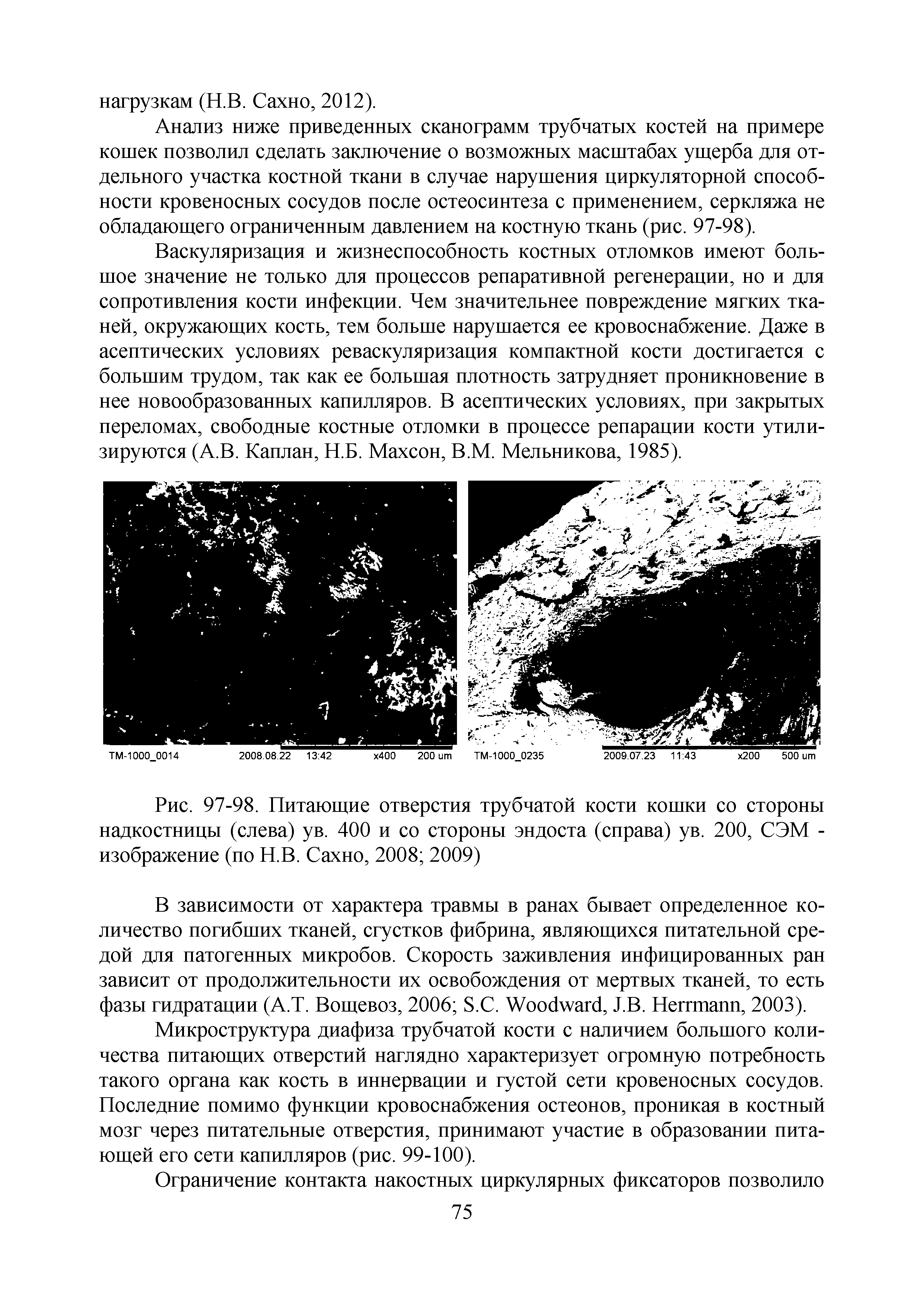 Рис. 97-98. Питающие отверстия трубчатой кости кошки со стороны надкостницы (слева) ув. 400 и со стороны эндоста (справа) ув. 200, СЭМ -изображение (по Н.В. Сахно, 2008 2009)...