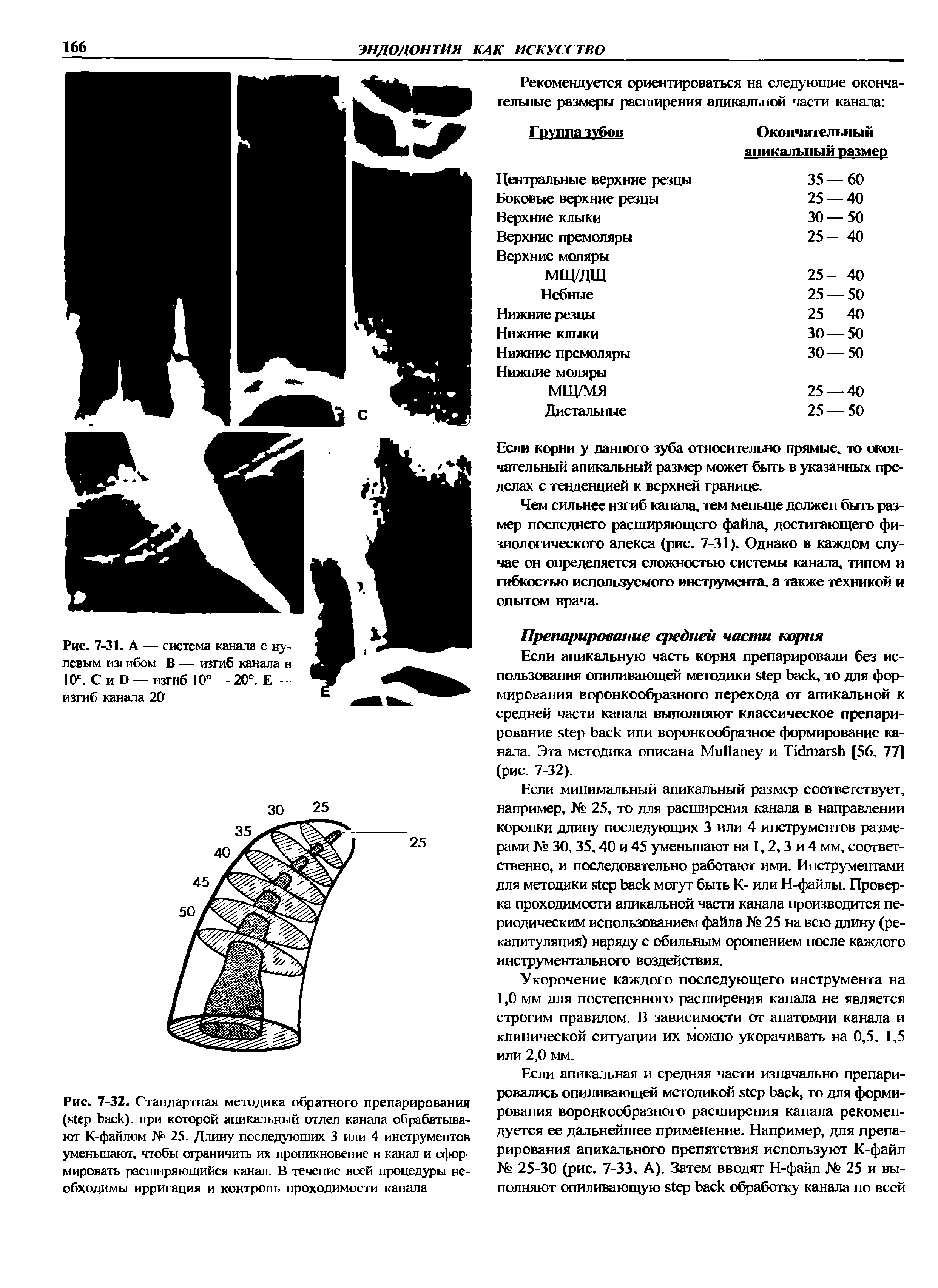 Рис. 7-32. Стандартная методика обратного препарирования ( ), при которой апикальный отдел канала обрабатывают К-файлом № 25. Длину последующих 3 или 4 инструментов уменьшают, чтобы ограничить их проникновение в канал и сформировать расширяющийся канал. В течение всей процедуры необходимы ирригация и контроль проходимости канала...