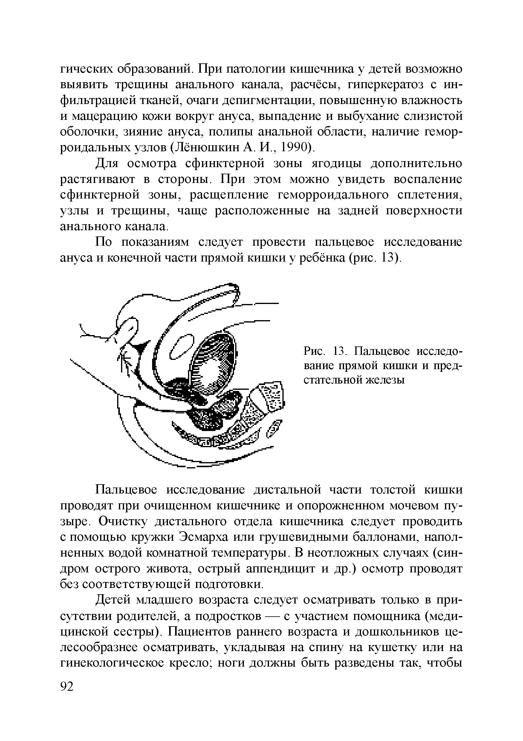 Рис. 13. Пальцевое исследование прямой кишки и предстательной железы...