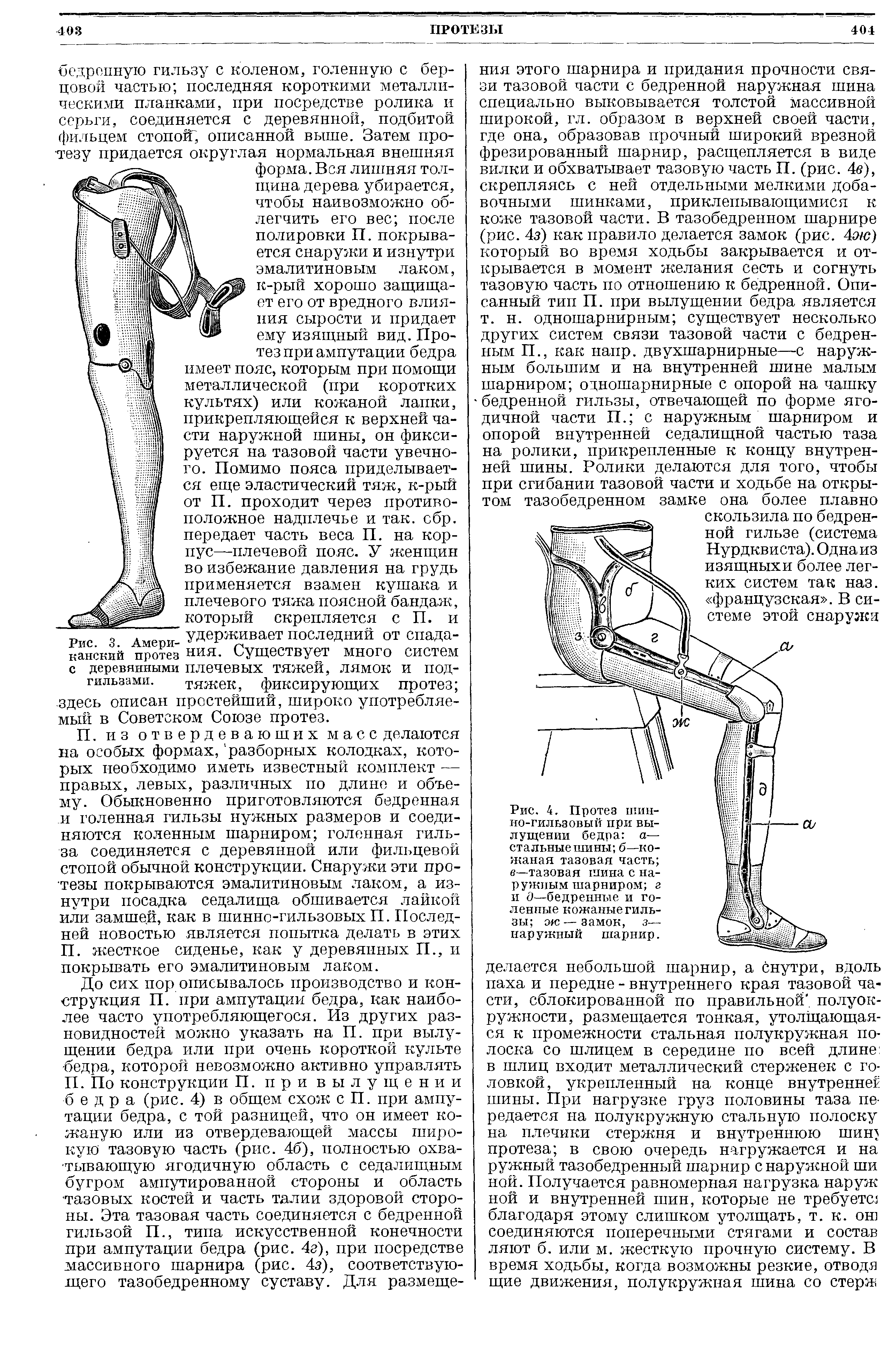 Рис. 4. Протез шинно-гильзовый при вылущении бедра а— стальные шины б—кожаная тазовая часть в—тазовая шина с наружным шарниром г и д—бедренные и го-ленные кожаные гильзы ж — замок, з— наружный шарнир.