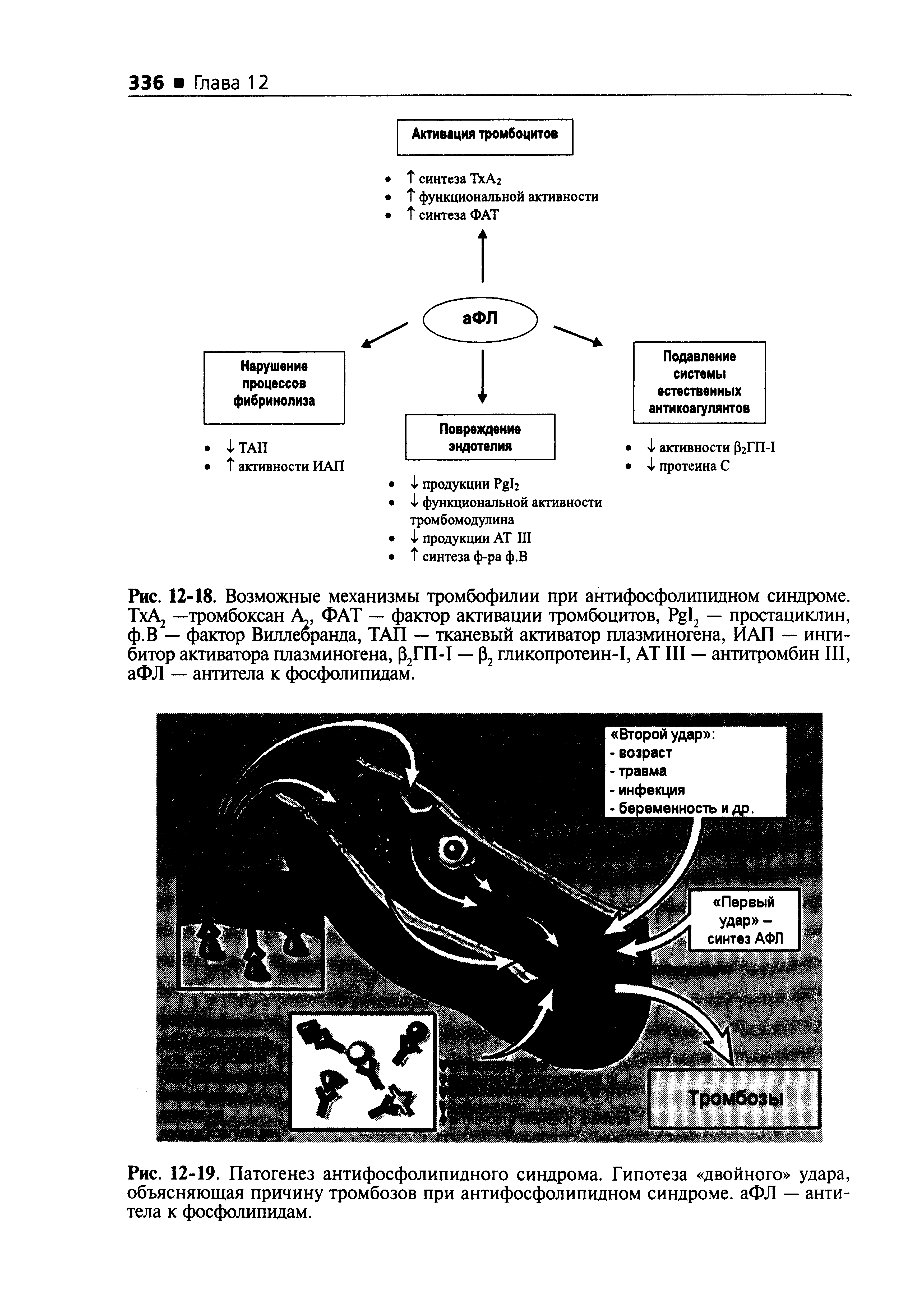 Рис. 12-18. Возможные механизмы тромбофилии при антифосфолипидном синдроме. T A —тромбоксан А, ФАТ — фактор активации тромбоцитов, P 2 — простациклин, ф.В — фактор Виллебранда, ТАП — тканевый активатор плазминогена, ИАП — ингибитор активатора плазминогена, р2ГП-1 — р2 гликопротеин-1, AT III — антитромбин III, аФЛ — антитела к фосфолипидам.