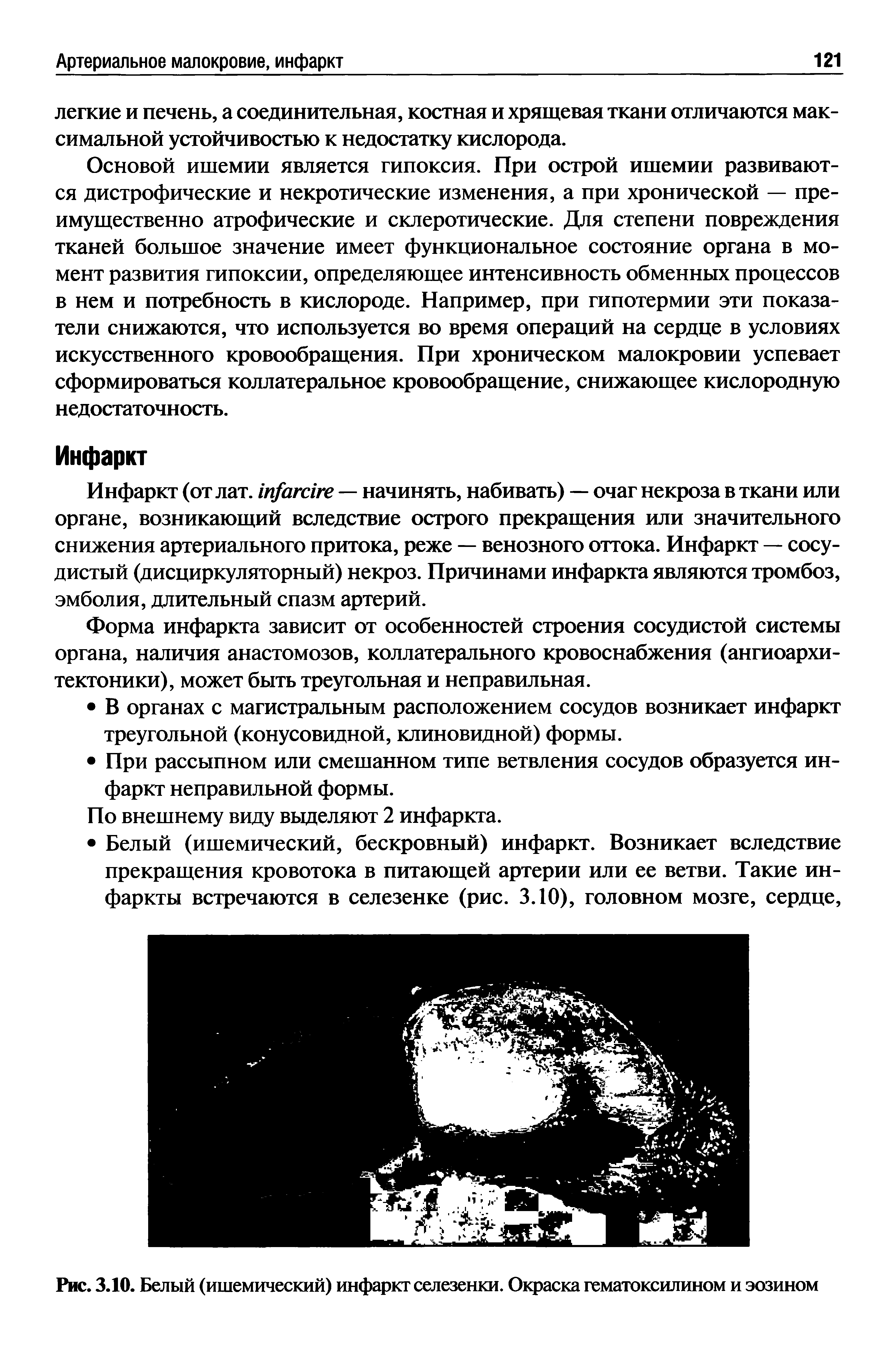 Рис. 3.10. Белый (ишемический) инфаркт селезенки. Окраска гематоксилином и эозином...