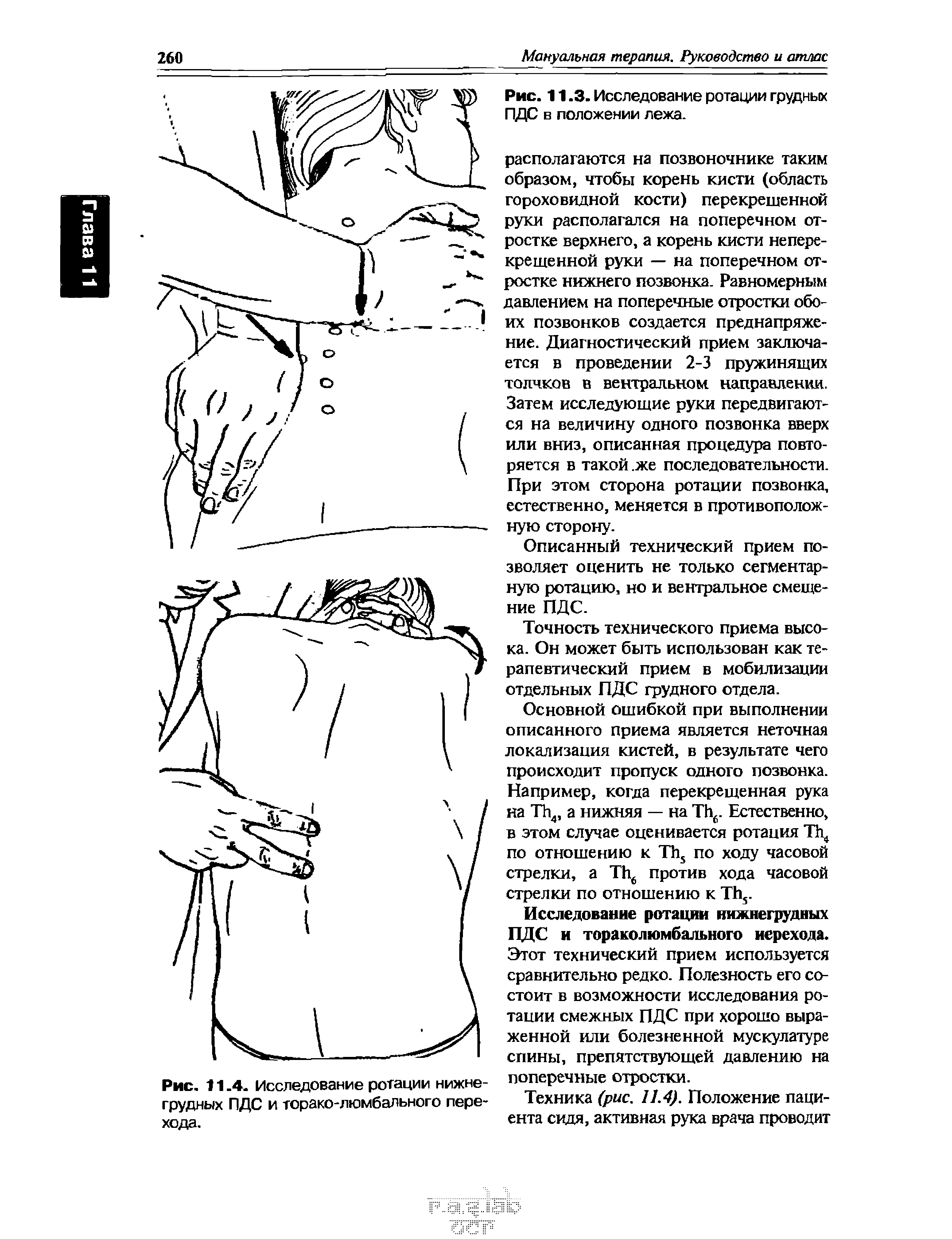 Рис. 11.4. Исследование ротации нижнегрудных ПДС и торако-люмбального перехода.