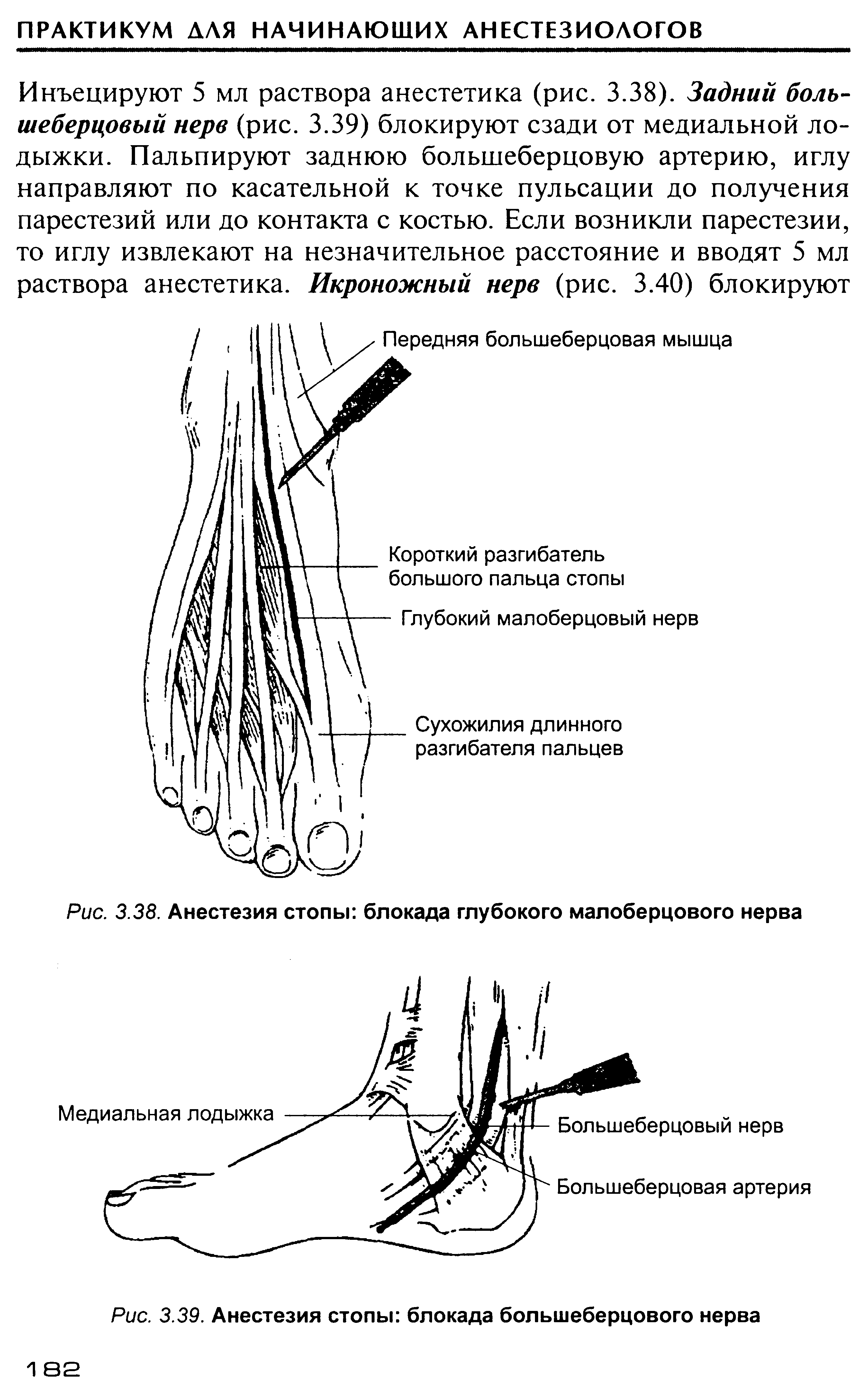 Рис. 3.38. Анестезия стопы блокада глубокого малоберцового нерва...