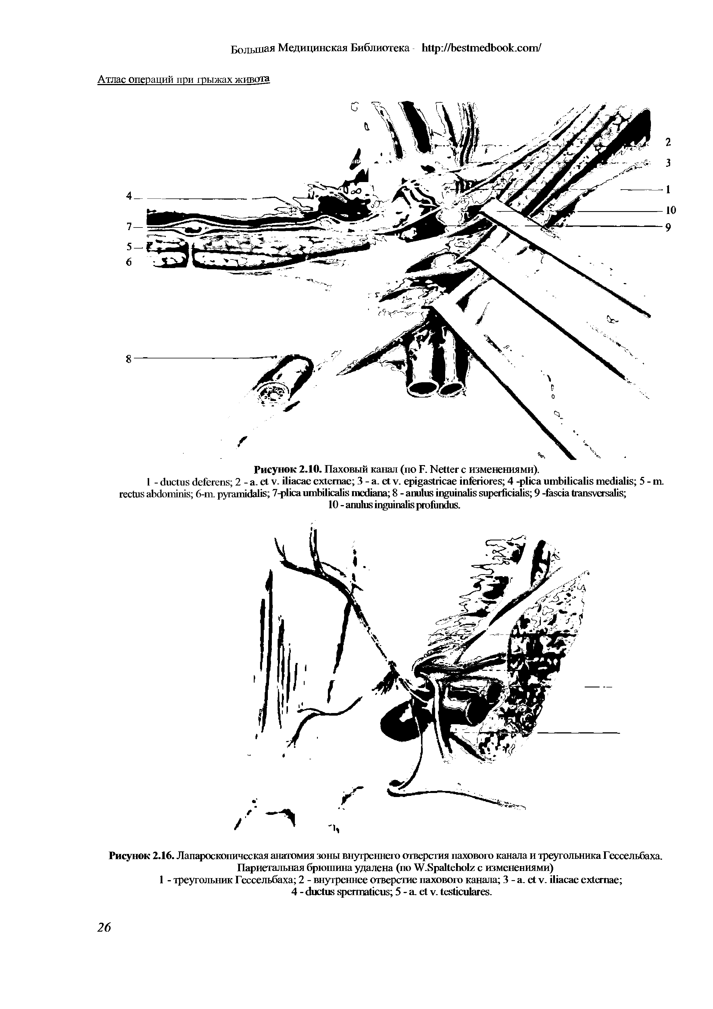 Рисунок 2.16. Лапароскопическая анатомия зоны внутреннего отверстия пахового канала и треугольника Гессельбаха. Париетальная брюшина удалена (по W.S с изменениями)...