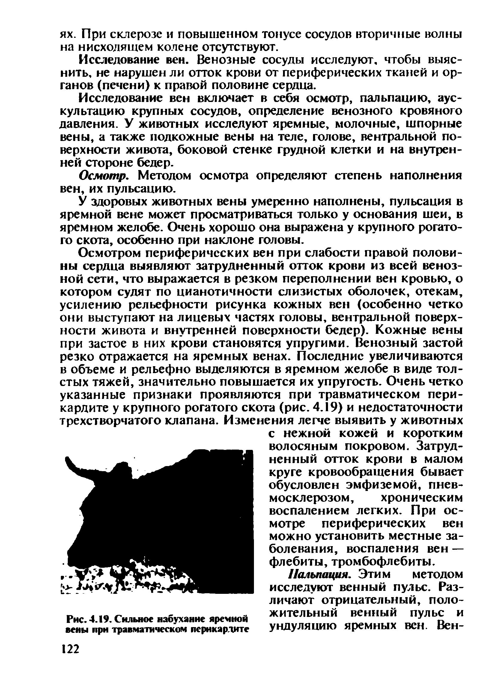 Рис.4.19. Сильное набухание яремной ительный венный пульс И вены при травматическом перикардите ундуляцию яремных ВСН. Вен-...