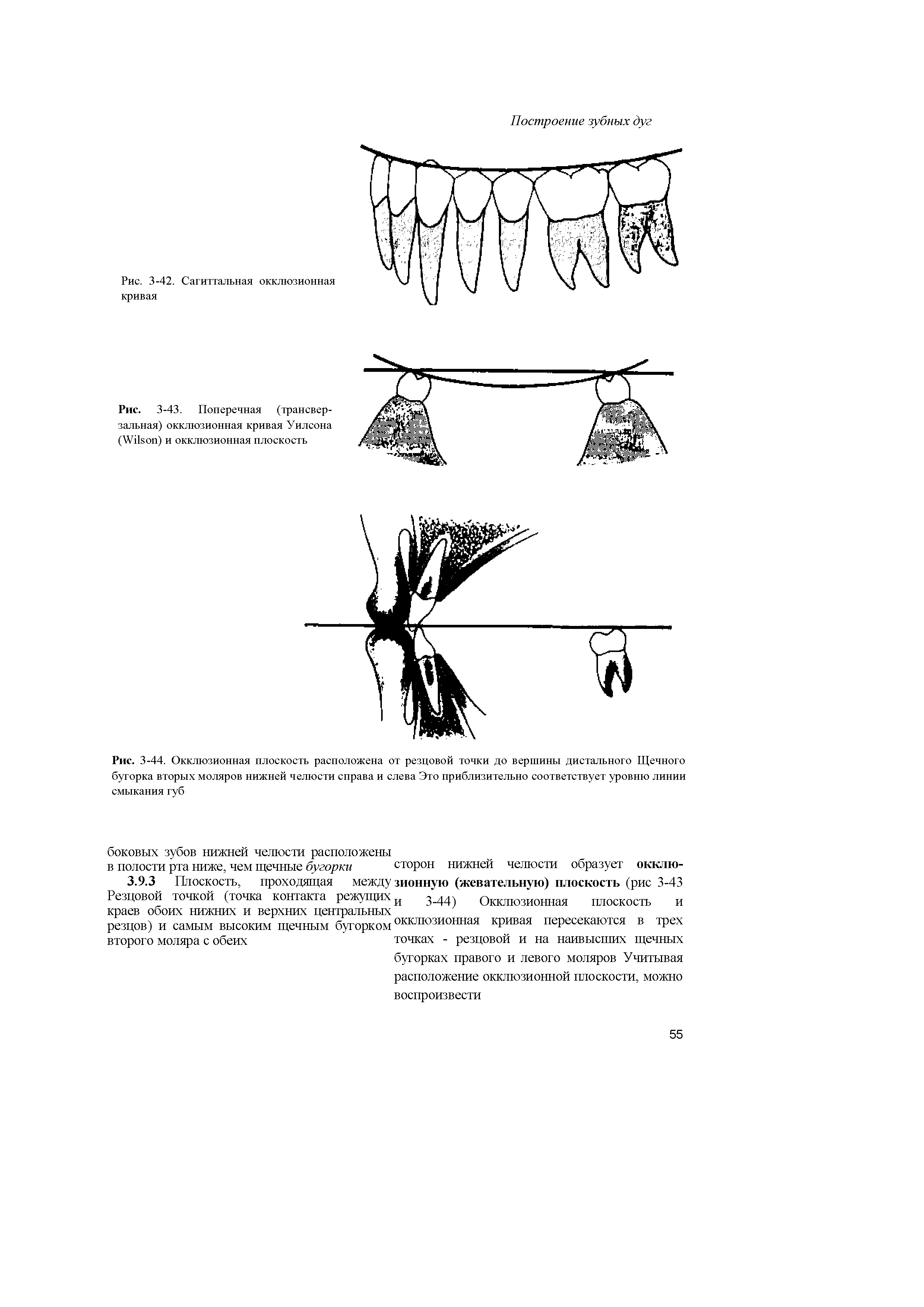 Рис. 3-43. Поперечная (трансвер-зальная) окклюзионная кривая Уилсона (W ) и окклюзионная плоскость...