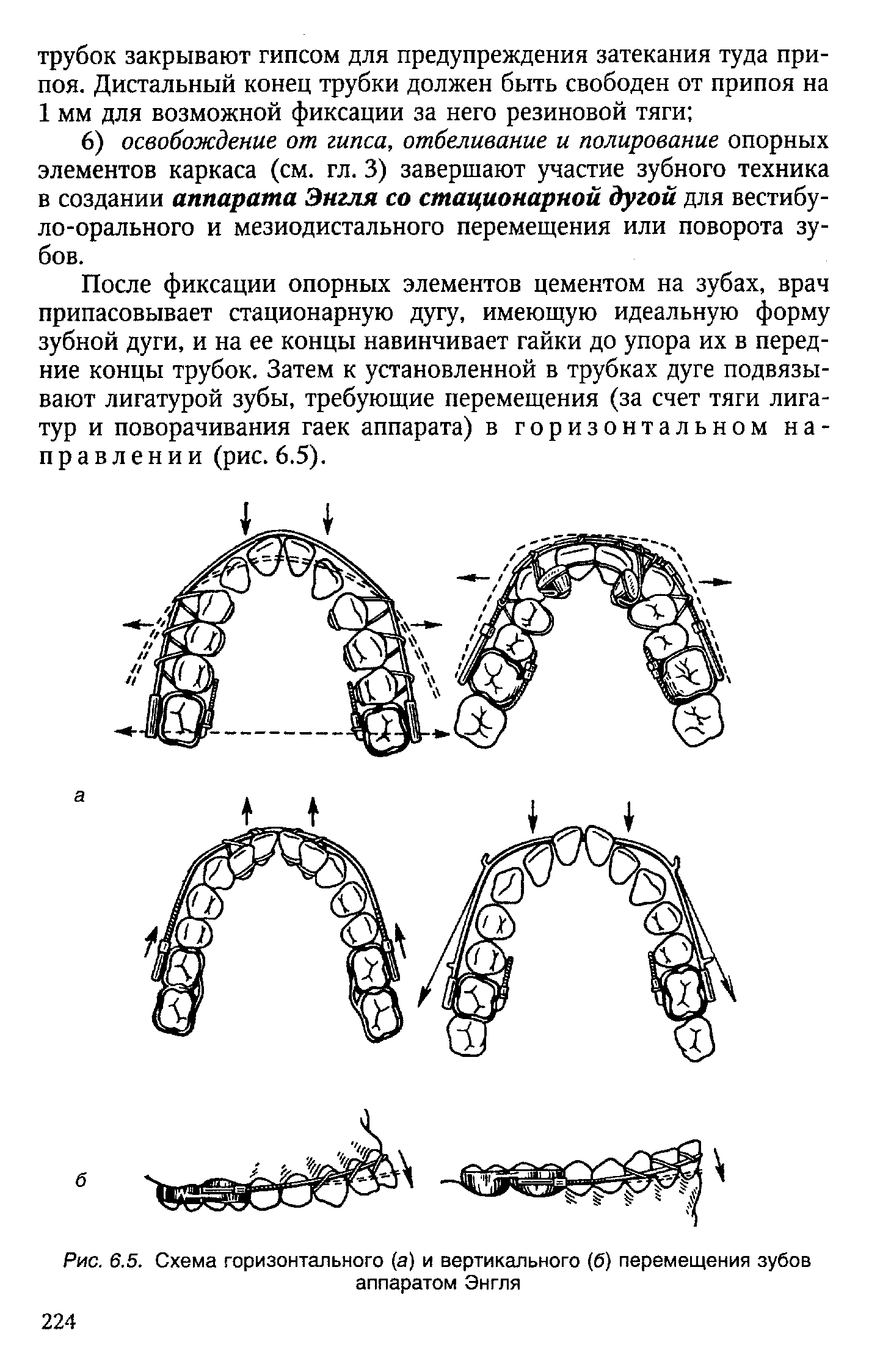 Рис. 6.5. Схема горизонтального (а) и вертикального (б) перемещения зубов аппаратом Энгля...