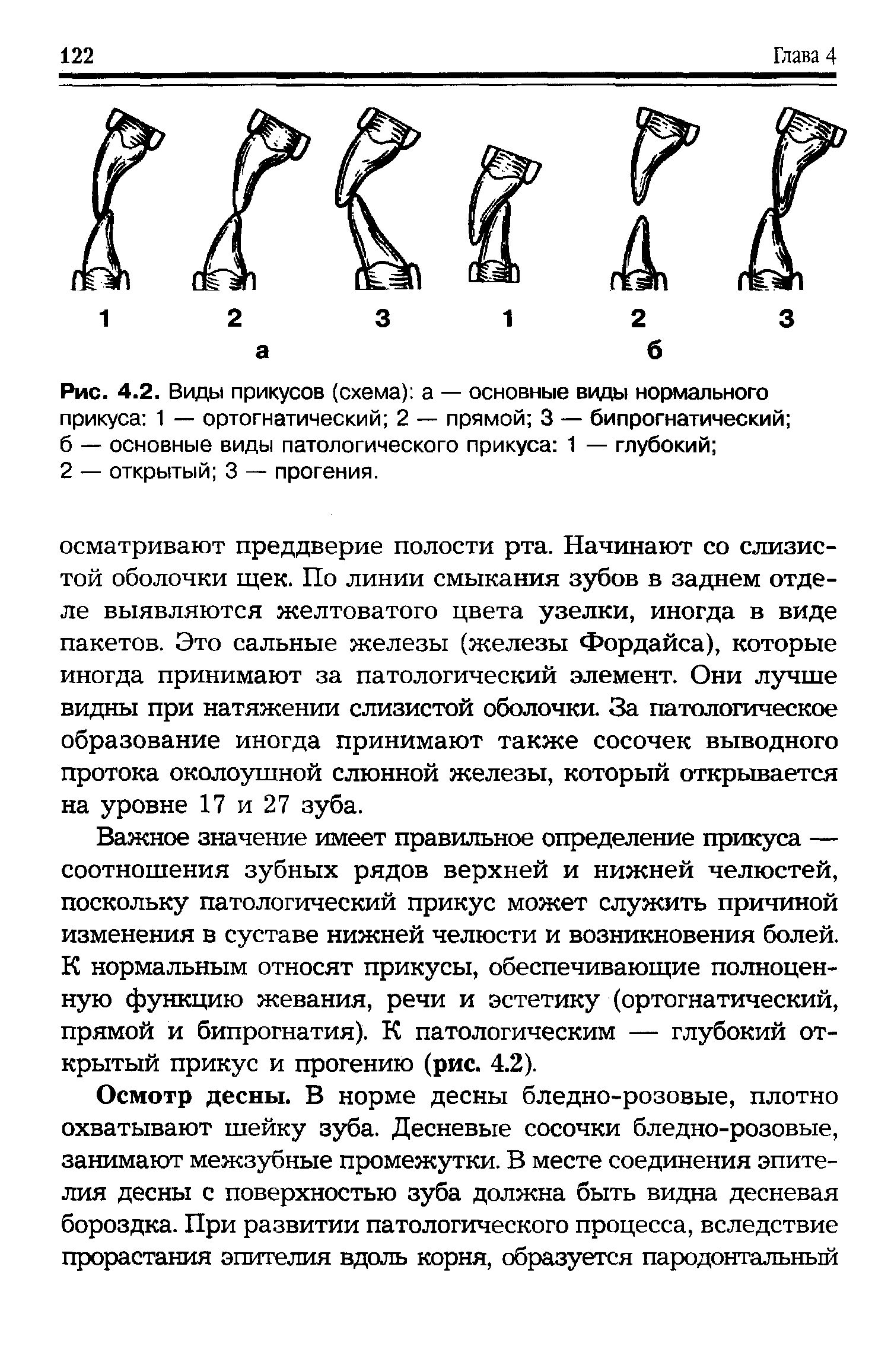 Рис. 4.2. Виды прикусов (схема) а — основные виды нормального прикуса 1 — ортогнатический 2 — прямой 3 — бипрогнатический б — основные виды патологического прикуса 1 — глубокий ...