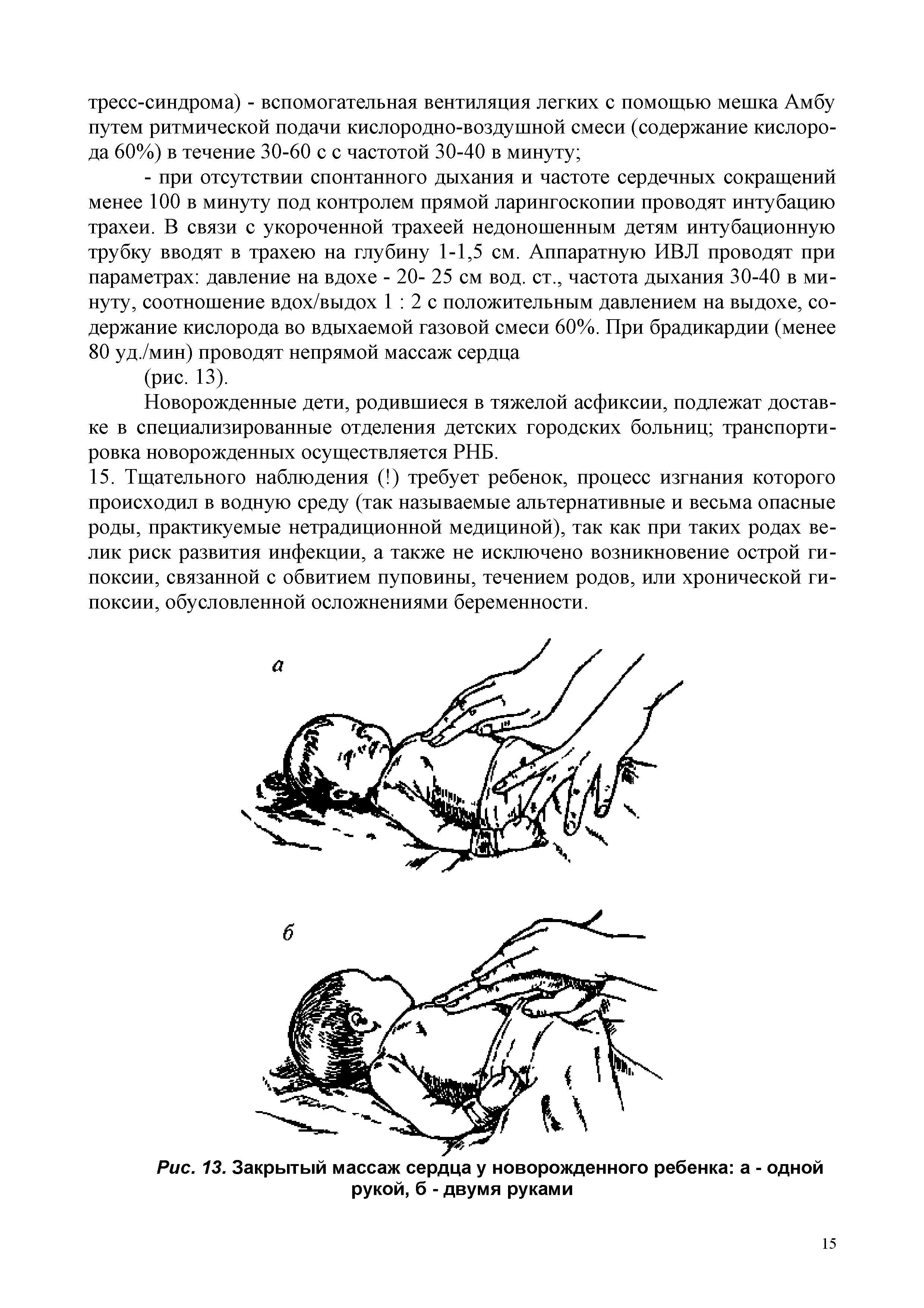 Рис. 13. Закрытый массаж сердца у новорожденного ребенка а - одной рукой, б - двумя руками...