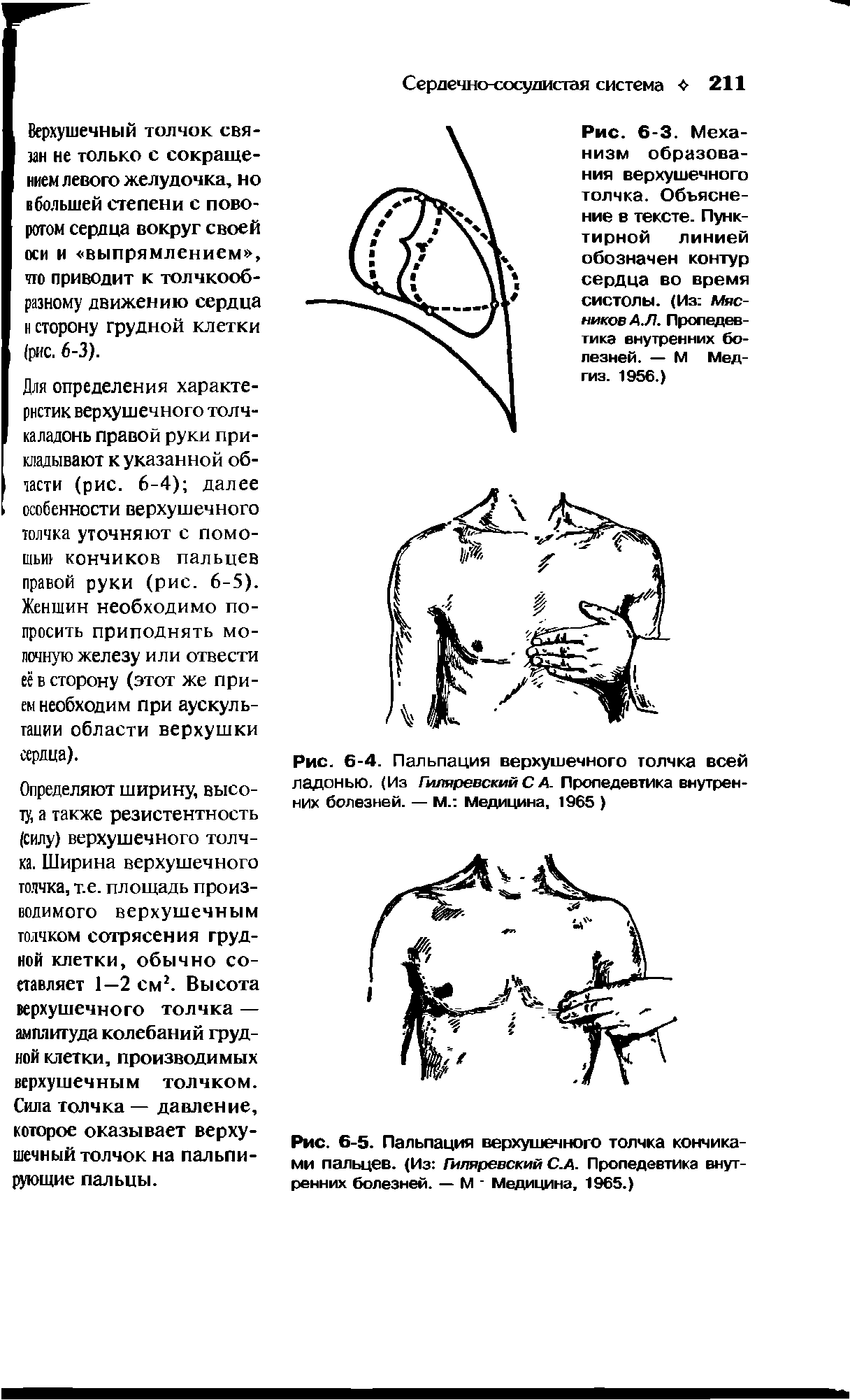 Рис. 6-5. Пальпация верхушечного толчка кончиками пальцев. (Из Гиляревский С.А. Пропедевтика внутренних болезней. — М Медицина, 1965.)...