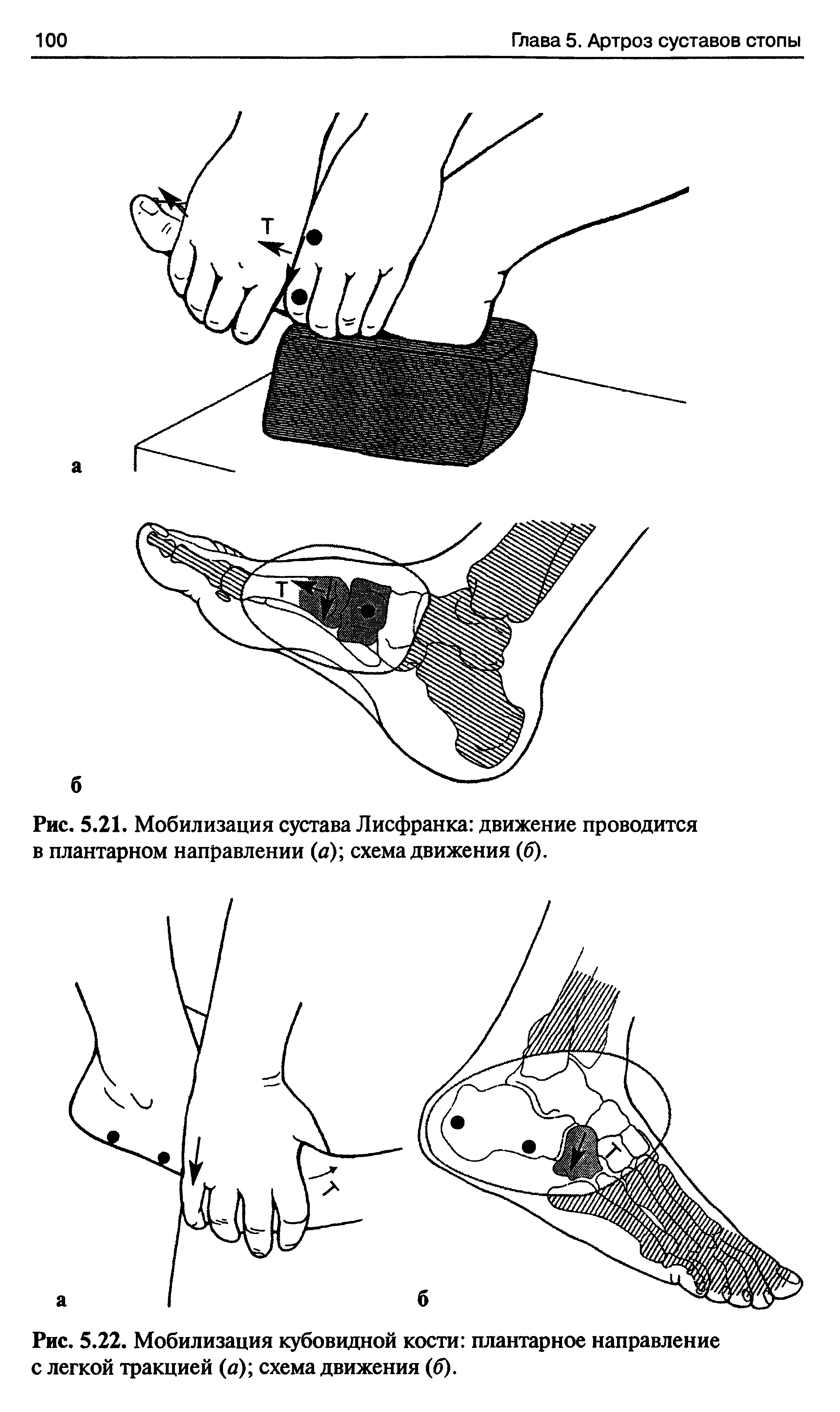 Рис. 5.22. Мобилизация кубовидной кости плантарное направление с легкой тракцией (а) схема движения (б).