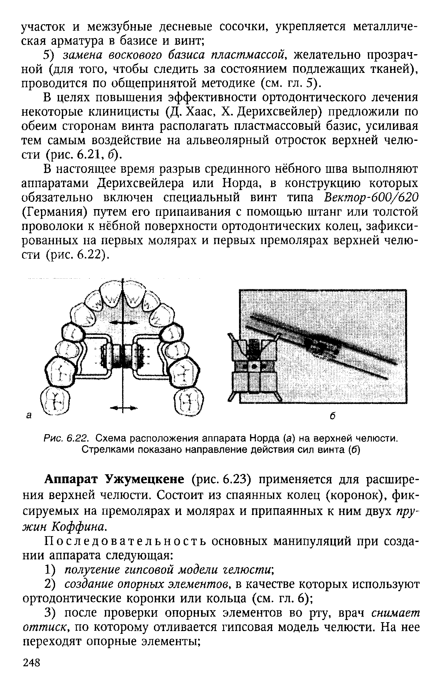 Рис. 6.22. Схема расположения аппарата Норда (а) на верхней челюсти. Стрелками показано направление действия сил винта (б)...