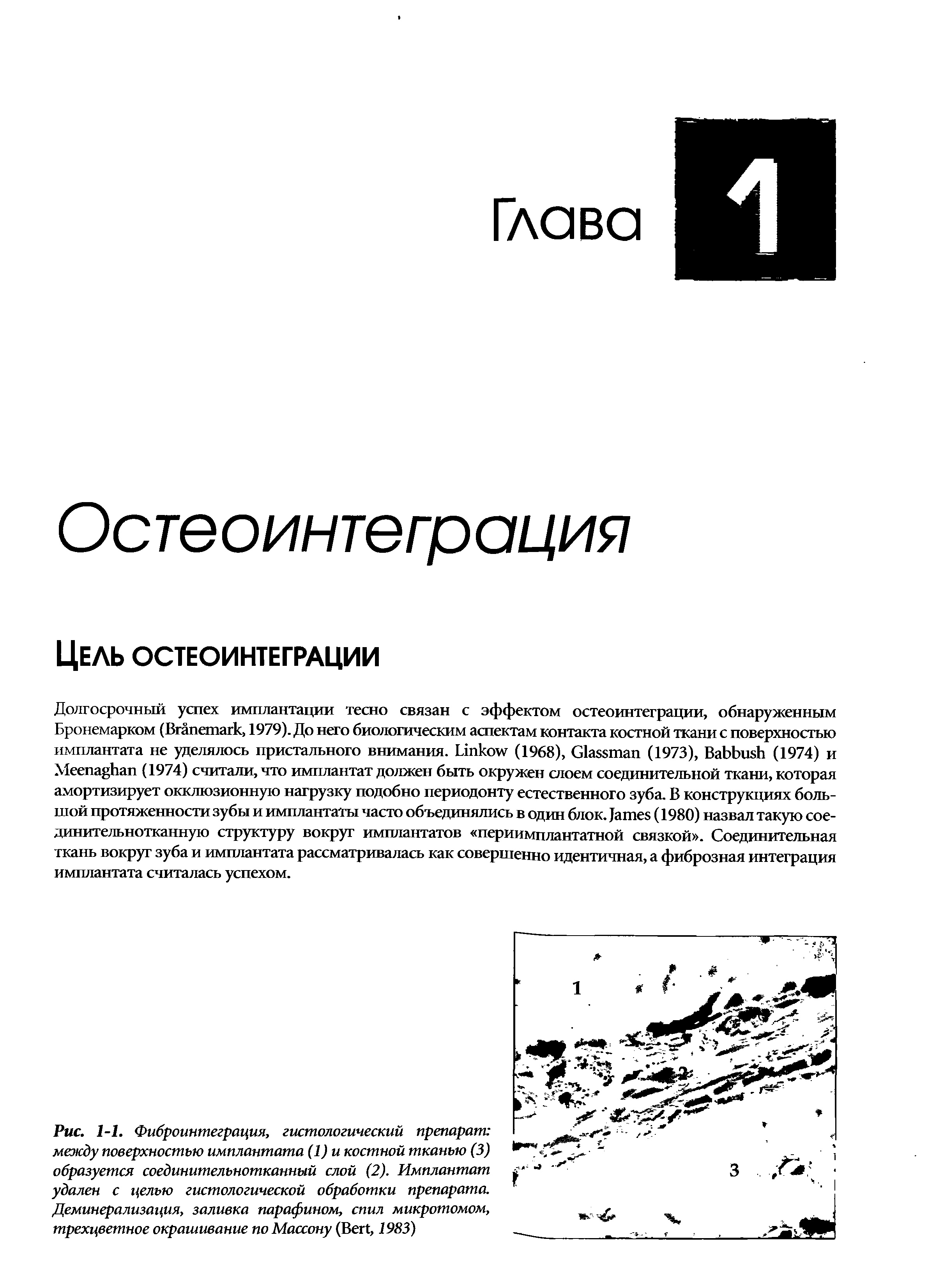 Рис. 1-1. Фиброинтеграция, гистологический препарат между поверхностью имплантата (1)и костной тканью (3) образуется соединительнотканный слой (2). Имплантат удален с целью гистологической обработки препарата. Деминерализация, заливка парафином, спил микротомом, трехцветное окрашивание по Массону (B , 1983)...