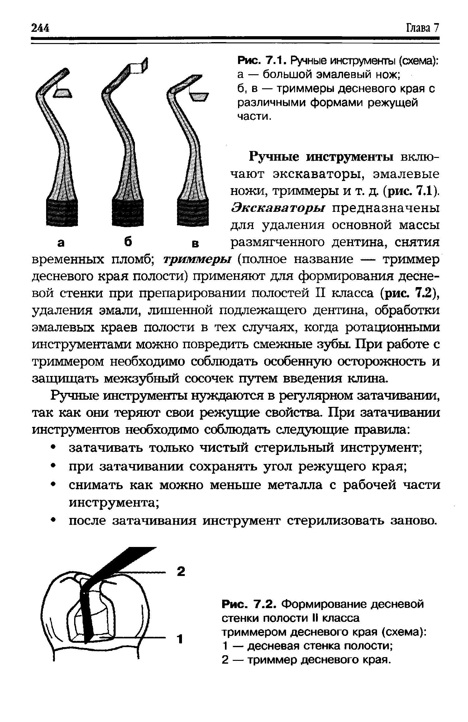 Рис. 7.2. Формирование десневой стенки полости II класса триммером десневого края (схема) ...