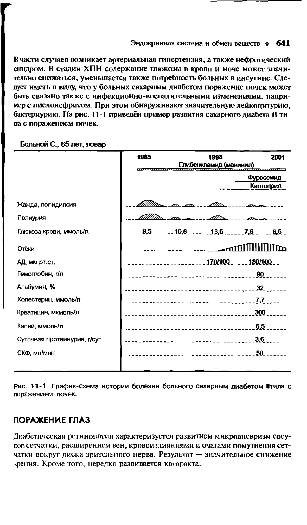 Рис. 11-1 График-схема истории болезни больного сахарным диабетом Итила с поражением лочек.