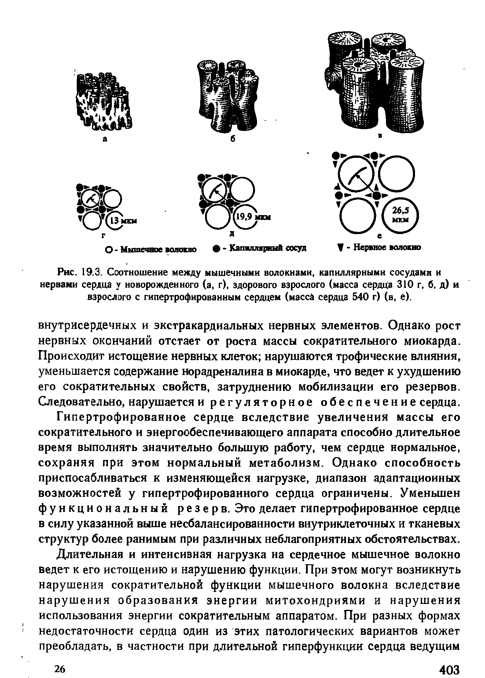 Рис. 19.3. Соотношение между мышечными волокнами, капиллярными сосудами и нервами сердца у новорожденного (а, г), здорового взрослого (масса сердца 310 г, б, д) и взрослого с гипертрофированным сердцем (масса сердца 540 г) (в, е).