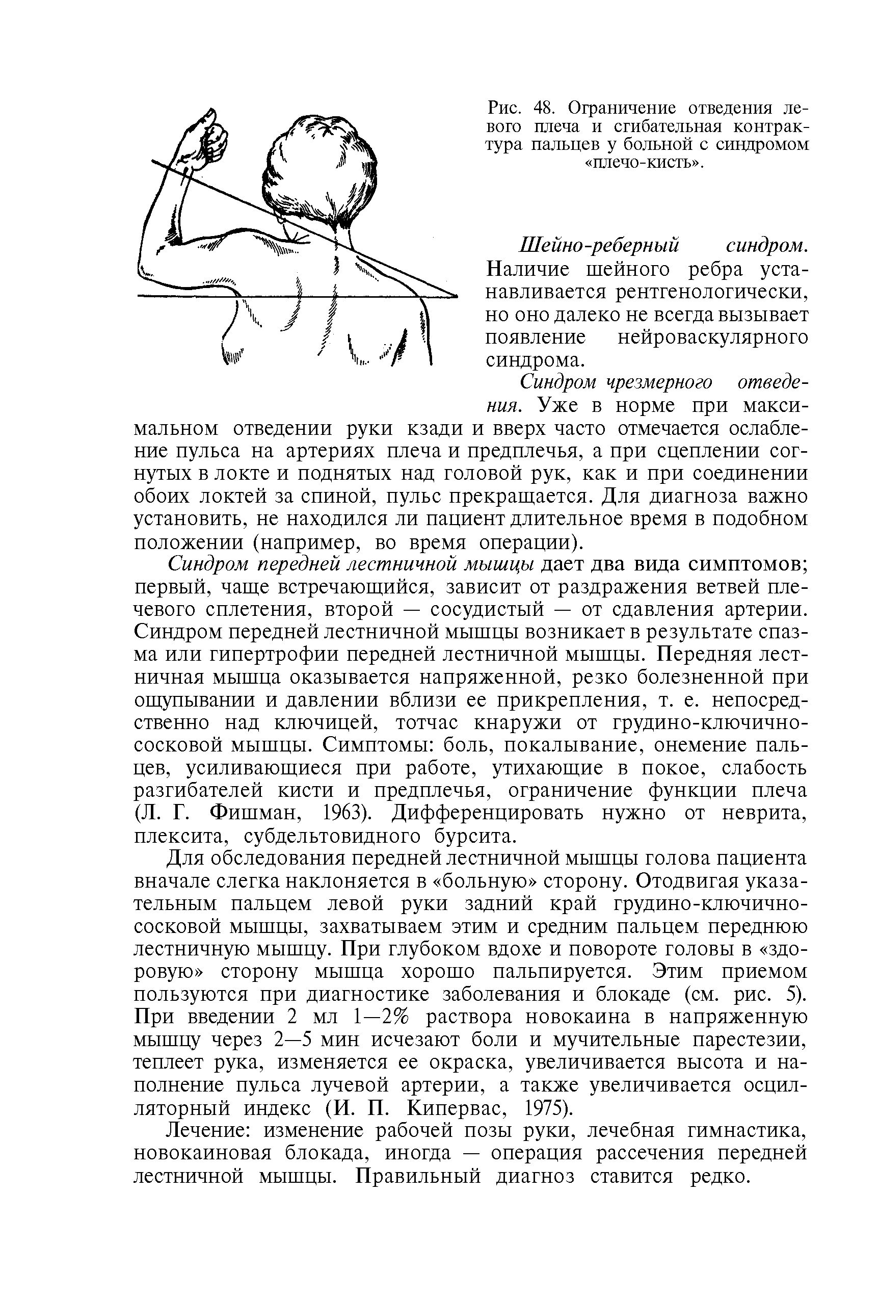 Рис. 48. Ограничение отведения левого плеча и сгибательная контрактура пальцев у больной с синдромом плечо-кисть .