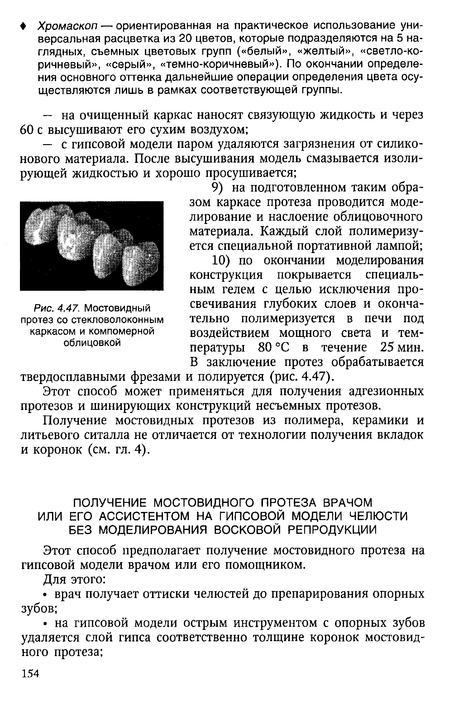 Рис. 4.47. Мостовидный протез со стекловолоконным каркасом и компомерной облицовкой...